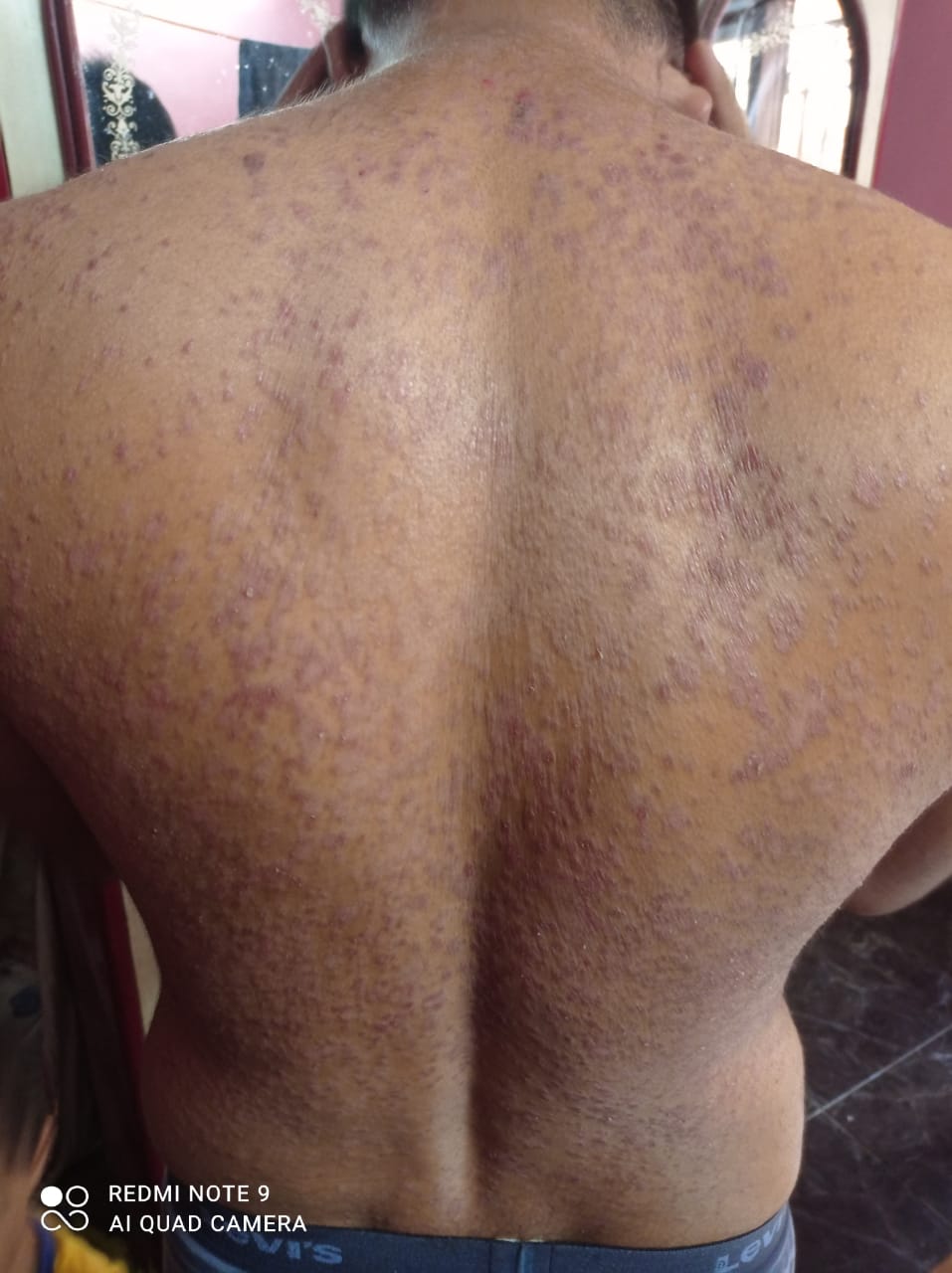 Konima Power Herbals Velathavalam Palakkad